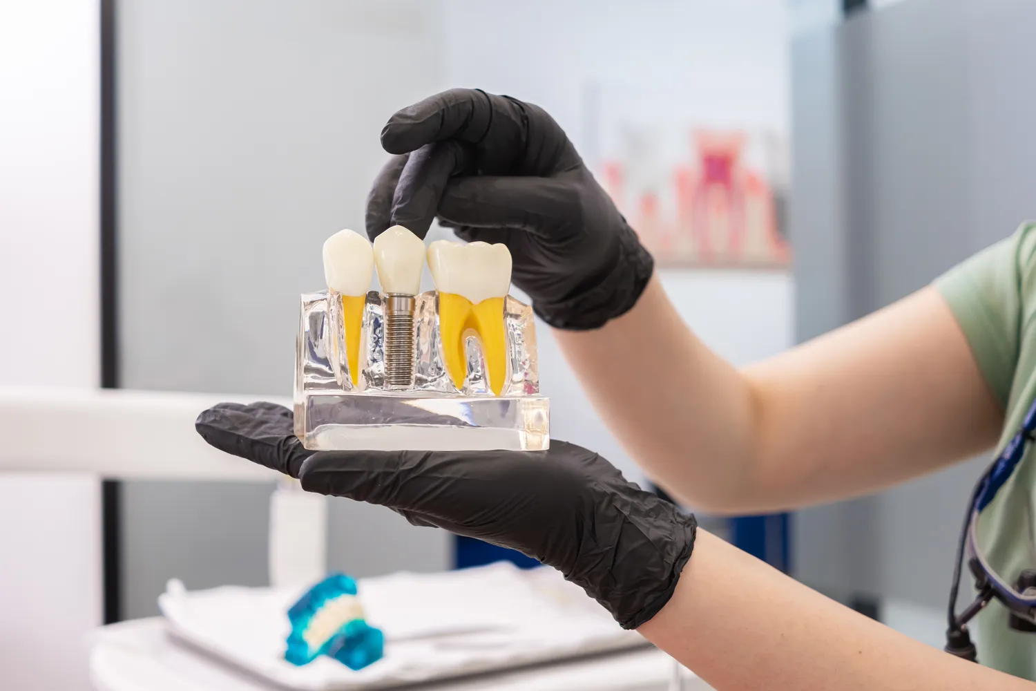 Co ile wymienia się implanty zębów?