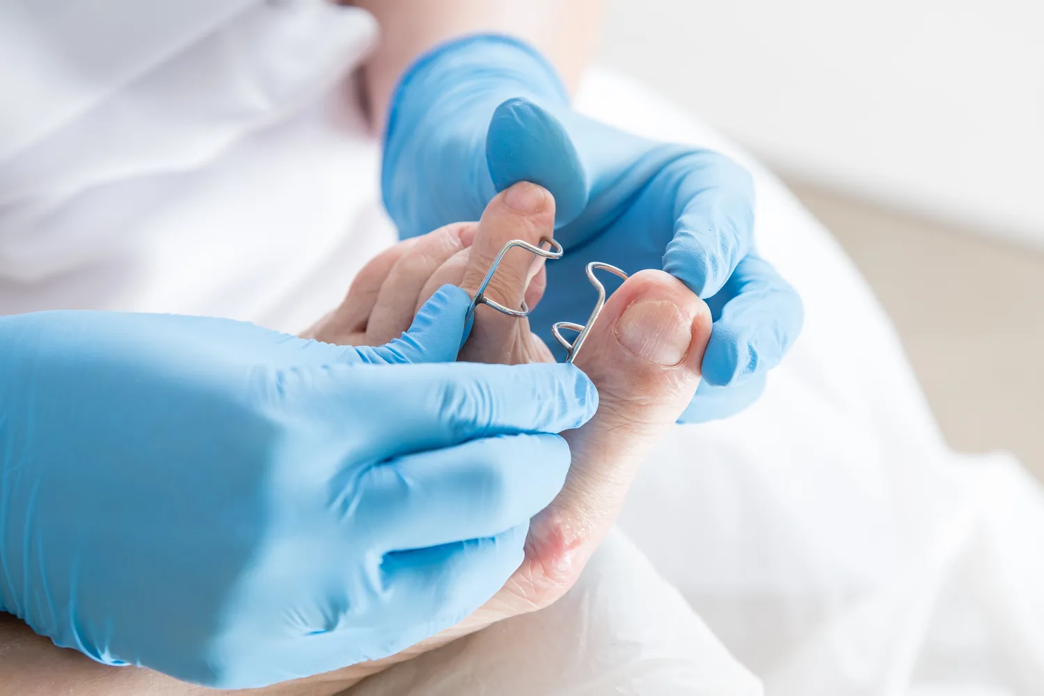 Podologia - pomaga rozwiązywać problemy zdrowotne stóp