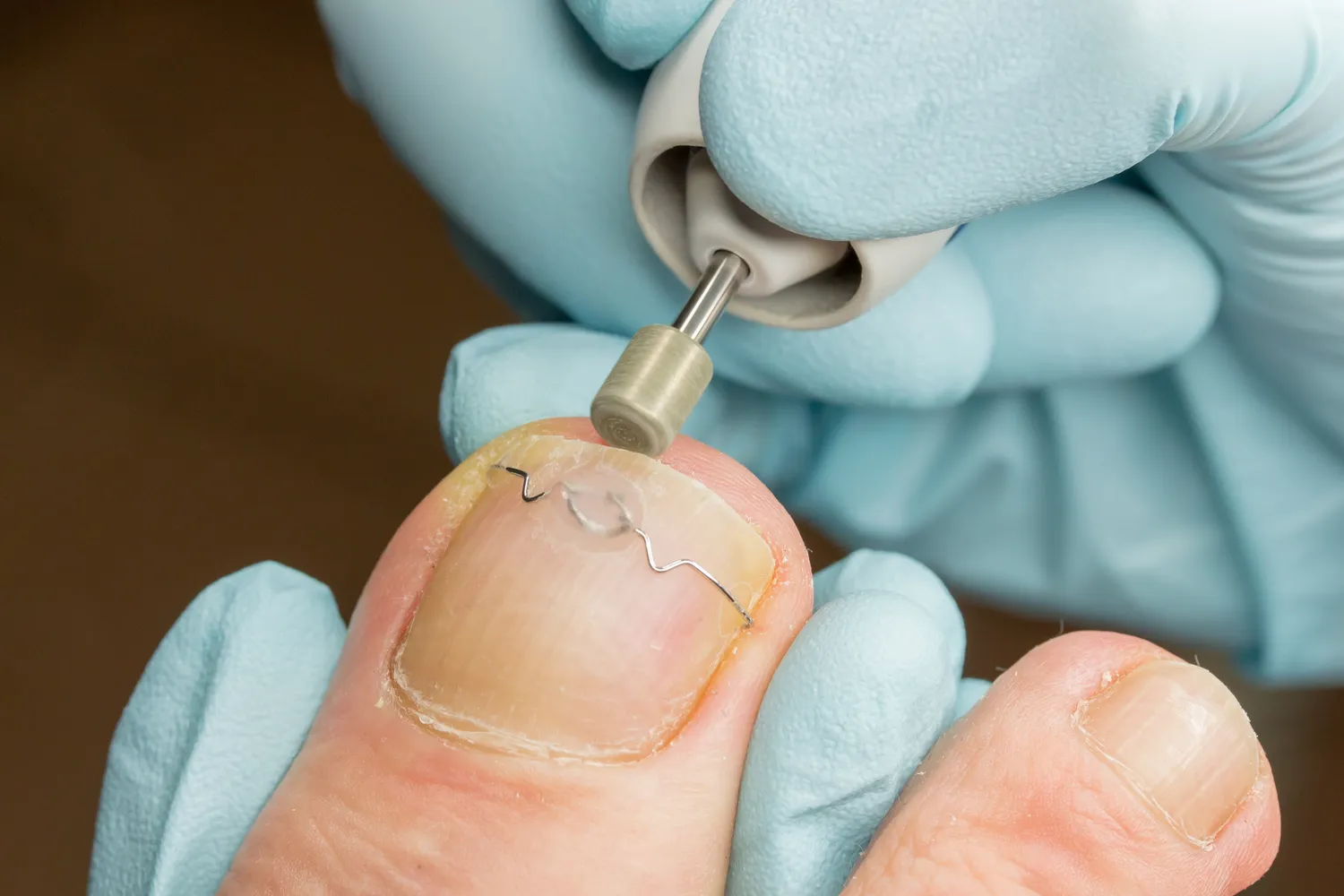 Zadbaj o swoje stopy już dziś - podologia na ratunek